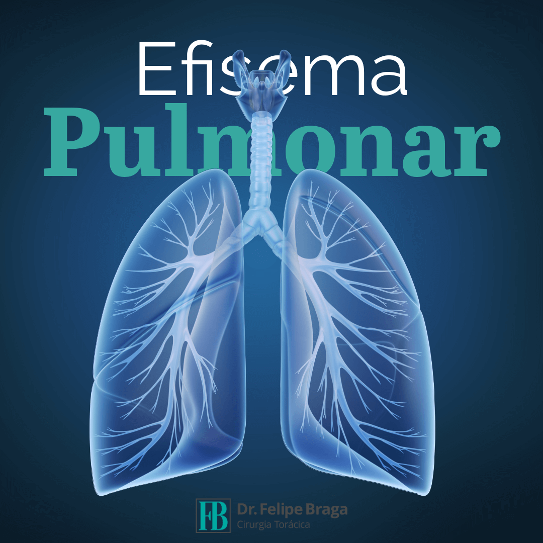 Enfisema pulmonar