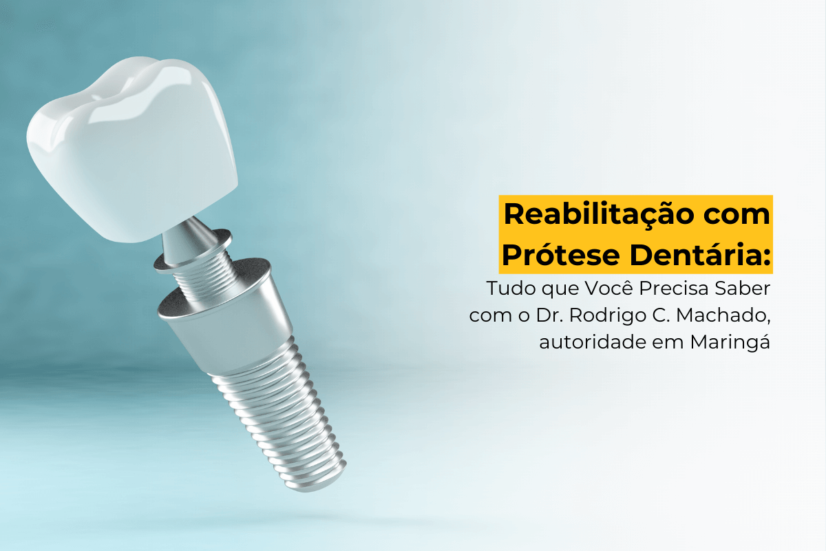 Reabilitação com Prótese Dentária: Tudo que Você Precisa Saber com o Dr. Rodrigo C. Machado, autoridade no assunto em Maringá.