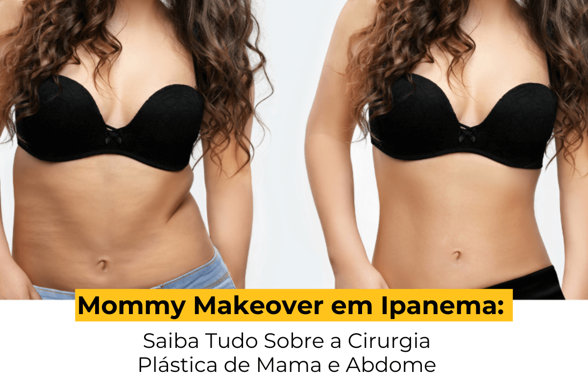 Mommy Makeover em Ipanema: Saiba Tudo Sobre a Cirurgia Plástica de Mama e Abdome